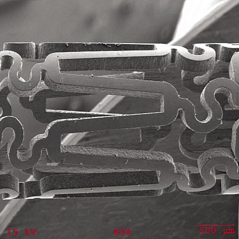 The cross sections of this laser-machined Nitinol stent measure 150µm (0.0059") across. Image courtesy LPL Systems.